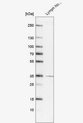 Western Blot: TMIGD2 Antibody [NBP1-81164] - Analysis in human lymph node tissue.