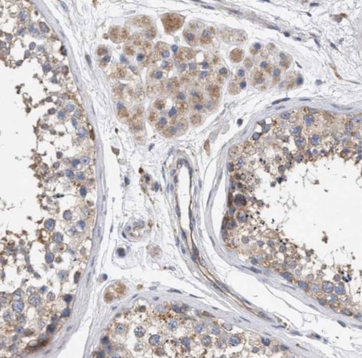 Staining of human testis shows moderate cytoplasmic positivity in cells in seminiferous ducts and Leydig cells.