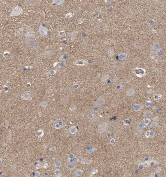 Staining of human cerebral cortex shows moderate cytoplasmic positivity in neuropil.