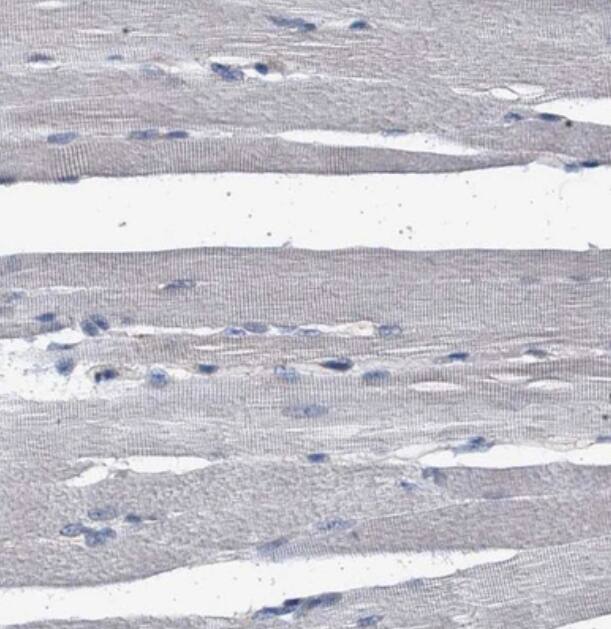  Staining of human skeletal muscle shows no positivity in myocytes as expected.