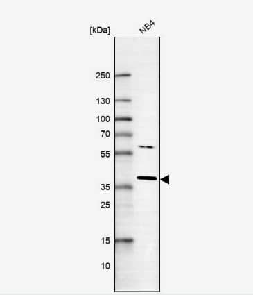 Western Blot: RNF166 Antibody [NBP1-81203] -Analysis in human cell line NB4.