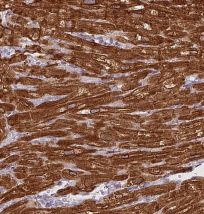 Immunohistochemistry-Paraffin: HRC Antibody [NBP1-81208] -  Staining of human heart muscle shows strong cytoplasmic positivity in cardiomyocytes.