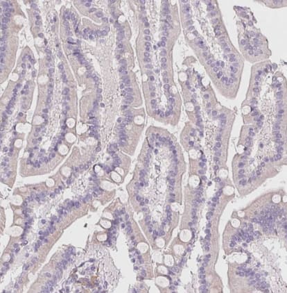 Immunohistochemistry-Paraffin: HRC Antibody [NBP1-81208] - Staining of human duodenum shows no positivity in glandular cells as expected.