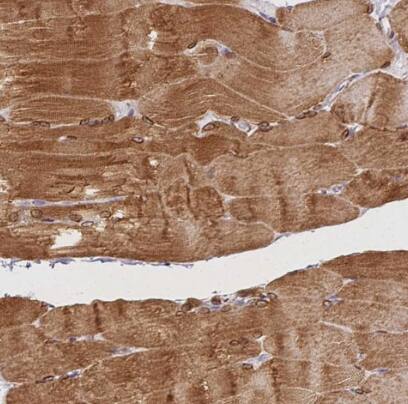 Immunohistochemistry-Paraffin: HRC Antibody [NBP1-81208] - Staining of human skeletal muscle shows strong cytoplasmic positivity in myocytes.