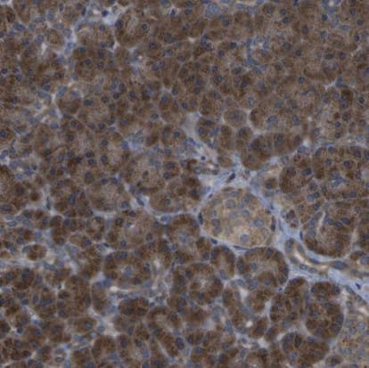 Immunohistochemistry-Paraffin DPM3 Antibody