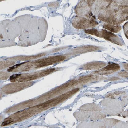 Immunohistochemistry-Paraffin DPM3 Antibody