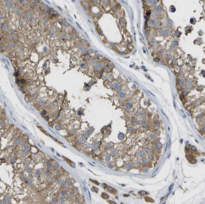 Immunohistochemistry-Paraffin: DPM3 Antibody [NBP1-81216] -Staining of human testis shows moderate cytoplasmic positivity in cells in seminiferous ducts and leydig cells.