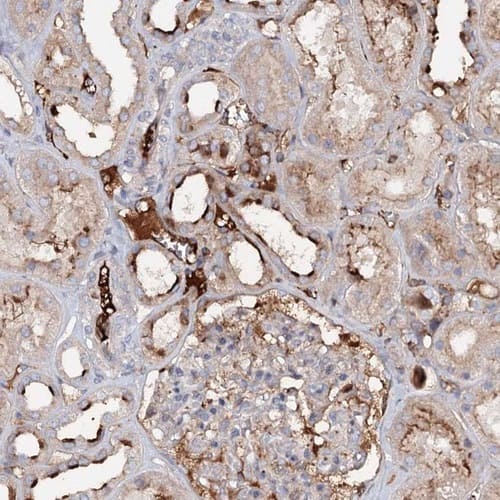 Staining of human kidney shows strong membranous positivity in cells in tubules.