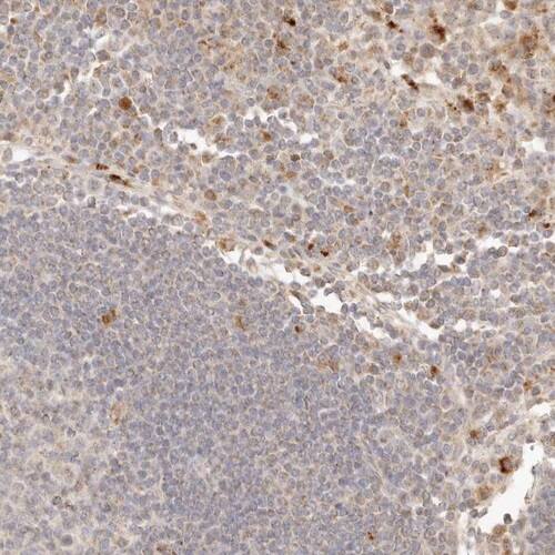 Staining of human Lymph node shows moderate cytoplasmic positivity in subset of non-germinal center cells.