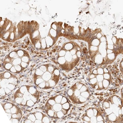 Staining of human Colon shows moderate cytoplasmic positivity in glandular cells.