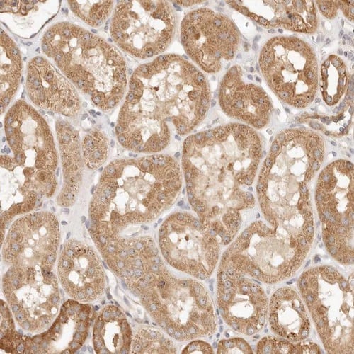 staining of human Kidney shows moderate cytoplasmic positivity in cells in tubules.
