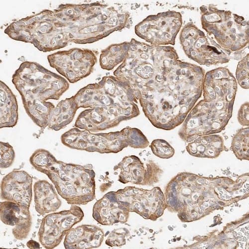 Staining of human Placenta shows moderate cytoplasmic and membranous positivity in trophoblastic cells.