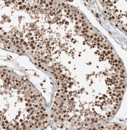 Staining of human testis shows strong nuclear positivity in cells in seminiferous ducts.