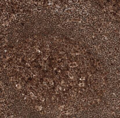 Staining of human tonsil shows strong nuclear positivity in germinal and non-germinal center cells.