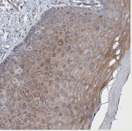 Immunohistochemistry-Paraffin: LGTN Antibody [NBP1-81308] - Staining of human cervix, uterine shows moderate cytoplasmic positivity in squamous epithelial cells.