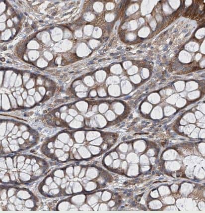 Immunohistochemistry-Paraffin: LGTN Antibody [NBP1-81308] - Saining of human colon shows moderate cytoplasmic positivity in glandular cells.