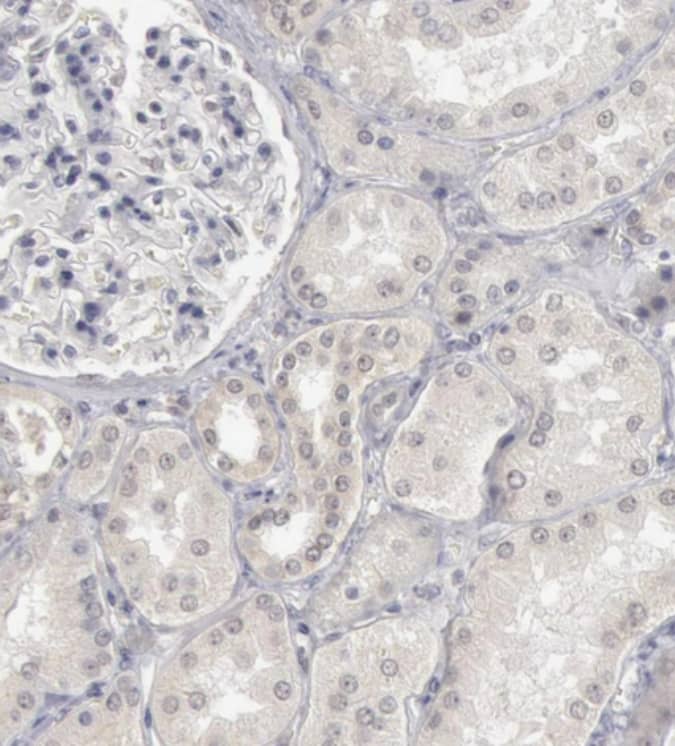 Staining of human kidney shows no positivity as expected.