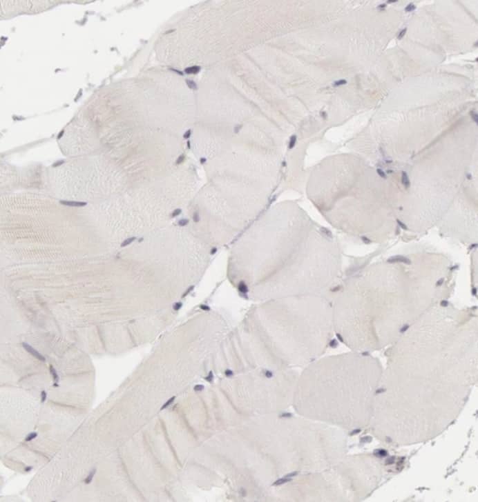 Staining of human skeletal muscle shows no positivity as expected.