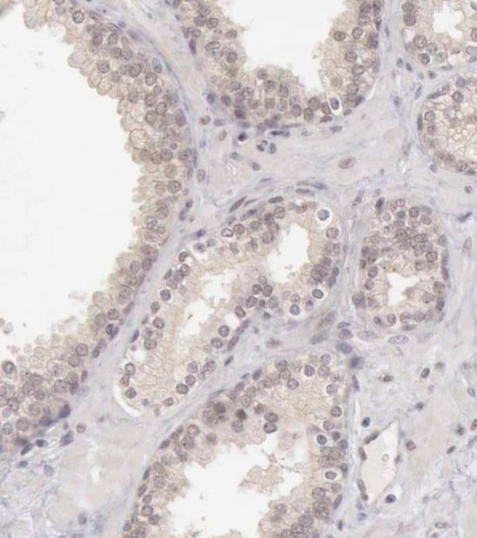 Staining of human prostate shows no positivity in glandular cells as expected.
