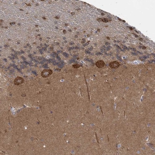 Immunohistochemistry-Paraffin TRIM2 Antibody - BSA Free