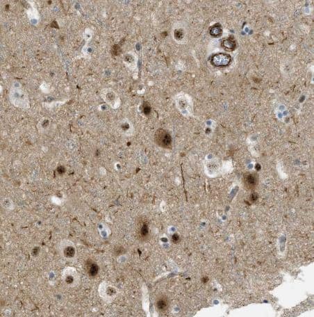 Immunohistochemistry-Paraffin LRRC8B Antibody - BSA Free