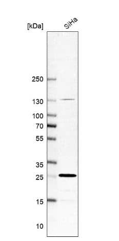 RAB21 Antibody [NBP1-81544] -Western Blot-Analysis in human cell line SiHa.