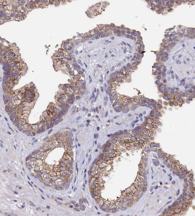  Staining of human prostate shows moderate granular cytoplasmic positivity in glandular cells.