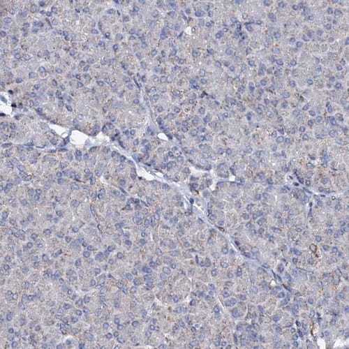 Immunohistochemistry-Paraffin UBE3C Antibody - BSA Free