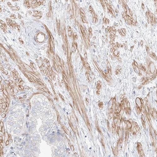 Staining of human prostate shows strong cytoplasmic positivity in smooth muscle cells