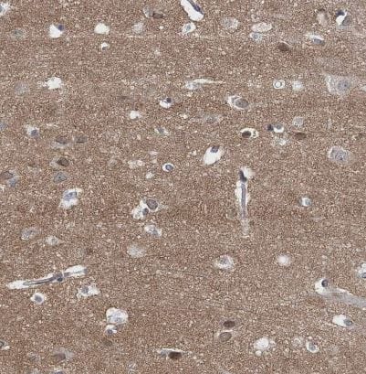 Immunohistochemistry-Paraffin: FAM126B Antibody [NBP1-81636] -Staining of human cerebral cortex shows moderate cytoplasmic positivity in neuropil and weak membranous positivity in neurons.