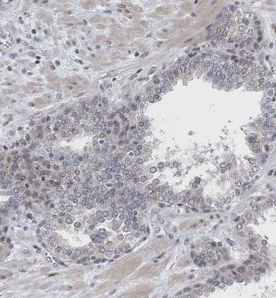 Immunohistochemistry-Paraffin: FAM126B Antibody [NBP1-81636] -Staining of human prostate shows no positivity in glandular cells as expected.