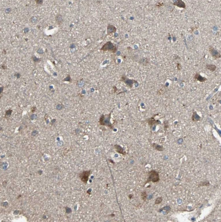 Staining of human cerebral cortex shows strong cytoplasmic positivity in neurons.