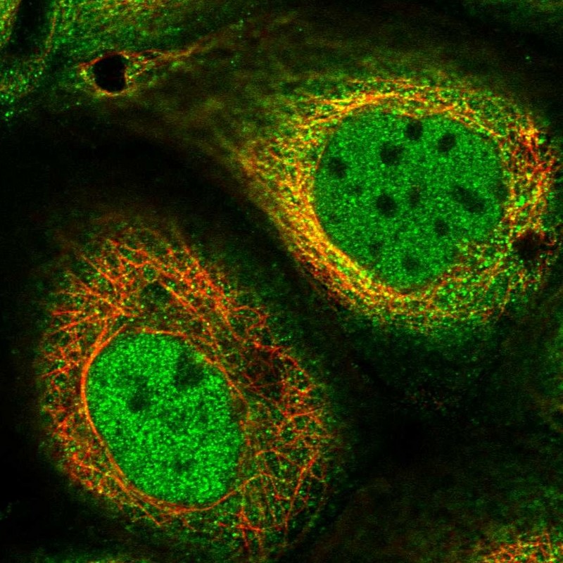 Staining of human cell line A-431 shows localization to nucleoplasm & cytosol.