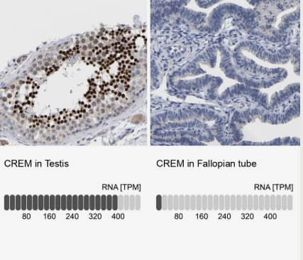 Immunohistochemistry-Paraffin: CREM Antibody [NBP1-81760] - Analysis in human testis and fallopian tube tissues using NBP1-81760 antibody. Corresponding CREM RNA-seq data are presented for the same tissues.