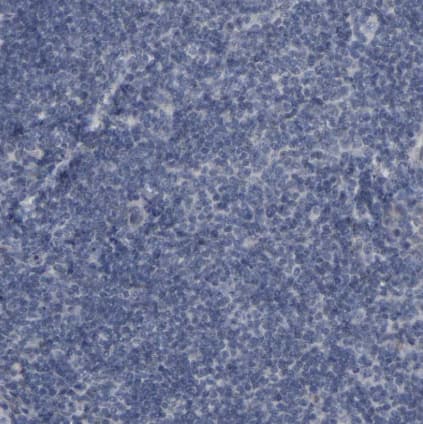 Immunohistochemistry-Paraffin: CREM Antibody [NBP1-81760] -Staining of human tonsil shows no nuclear positivity in non-germinal center cells as expected.