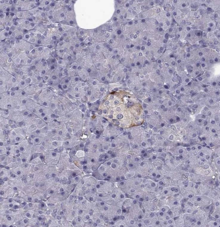 Staining of human pancreas shows weak cytoplasmic positivity in islets of Langerhans.