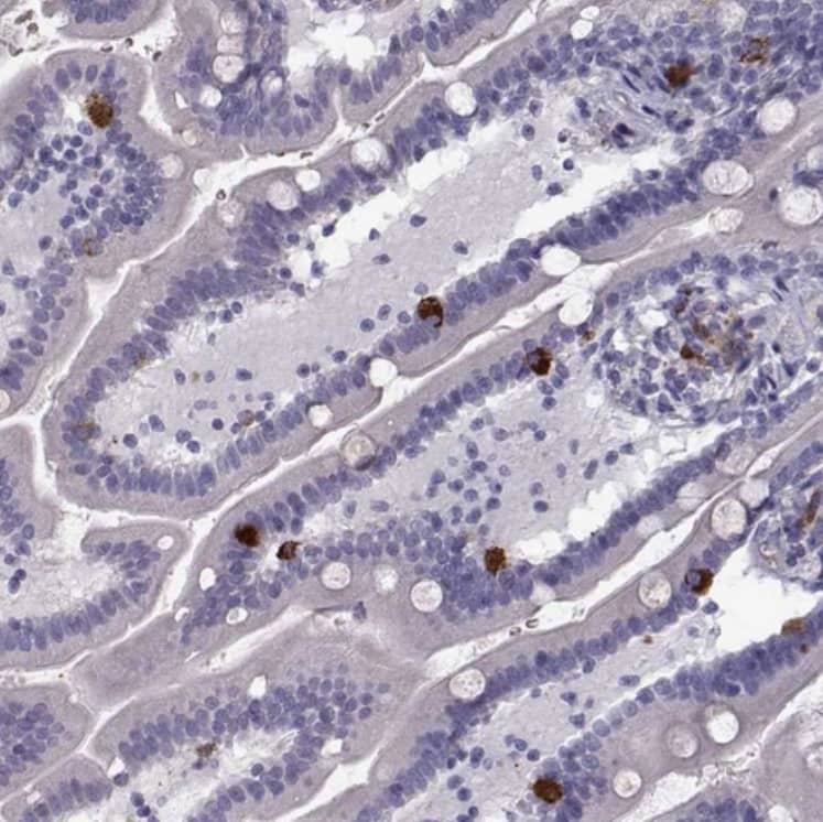 Staining of human duodenum shows strong cytoplasmic positivity in enteroendocrine cells.