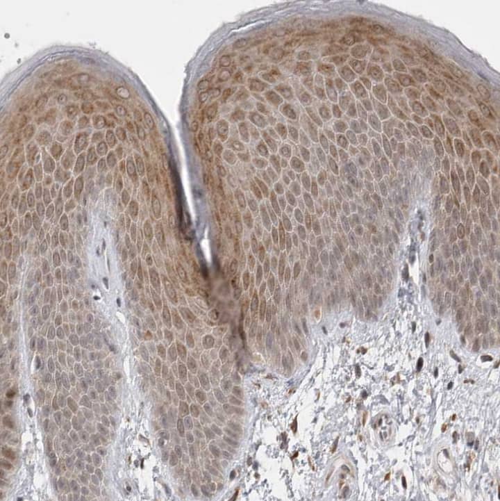 Immunohistochemistry-Paraffin GGT6 Antibody - BSA Free