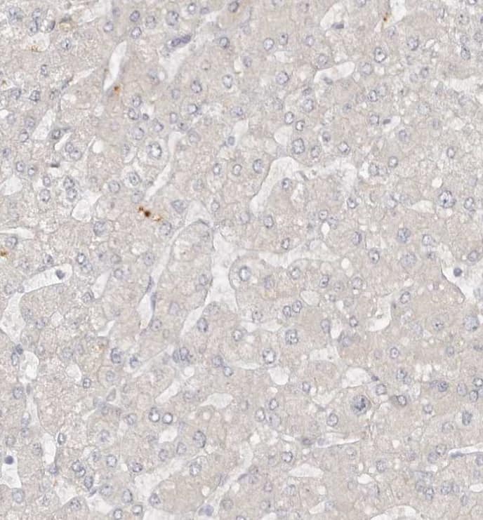 Immunohistochemistry-Paraffin GGT6 Antibody - BSA Free