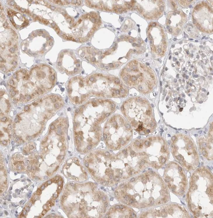 Immunohistochemistry-Paraffin GGT6 Antibody - BSA Free