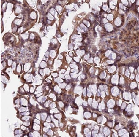 Immunohistochemistry-Paraffin: PRELID2 Antibody [NBP1-81937] -Staining of human small intestine shows moderate cytoplasmic positivity in glandular cells.