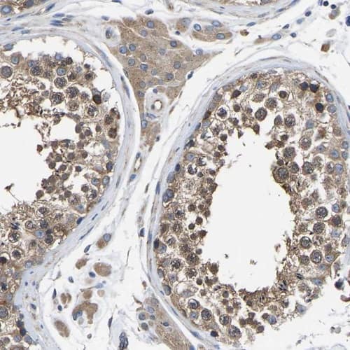 Staining of human testis shows moderate cytoplasmic positivity in cells in seminiferous ducts.