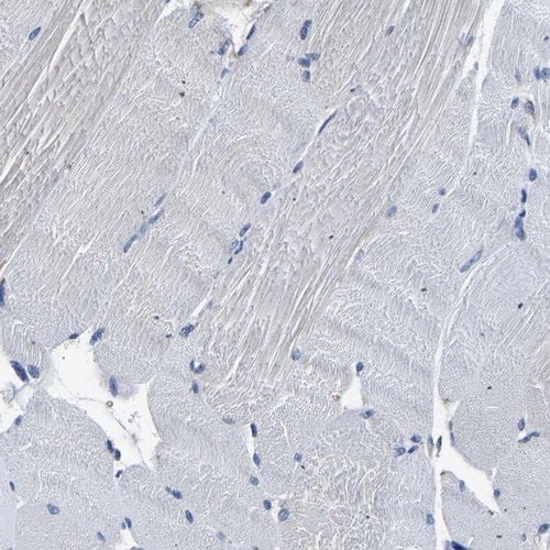 Staining of human skeletal muscle shows no positivity in myocytes as expected.