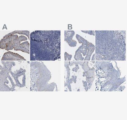 Immunohistochemistry-Paraffin: SPATA18 Antibody [NBP1-81984] - Staining of human fallopian tube, lymph node, prostate and skin using Anti-SPATA18 antibody NBP1-81984 (A) shows similar protein distribution across tissues to independent antibody (B).