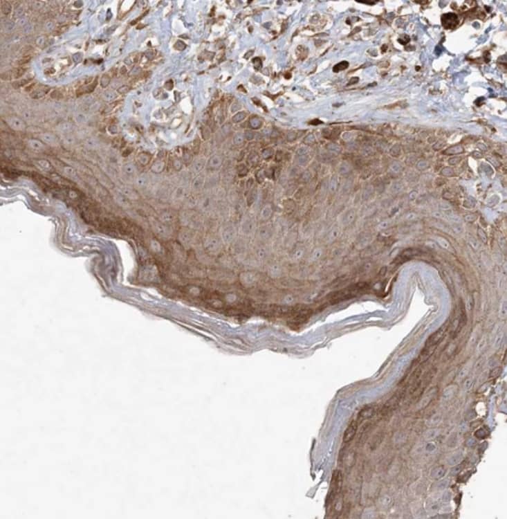 Staining of human skin shows moderate cytoplasmic positivity in squamous epithelial cells.