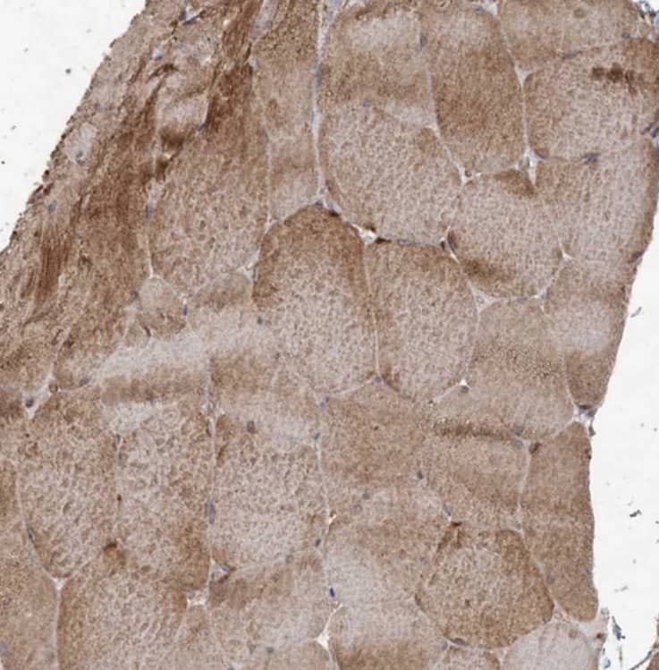 Staining of human skeletal muscle shows moderate cytoplasmic positivity in myocytes.