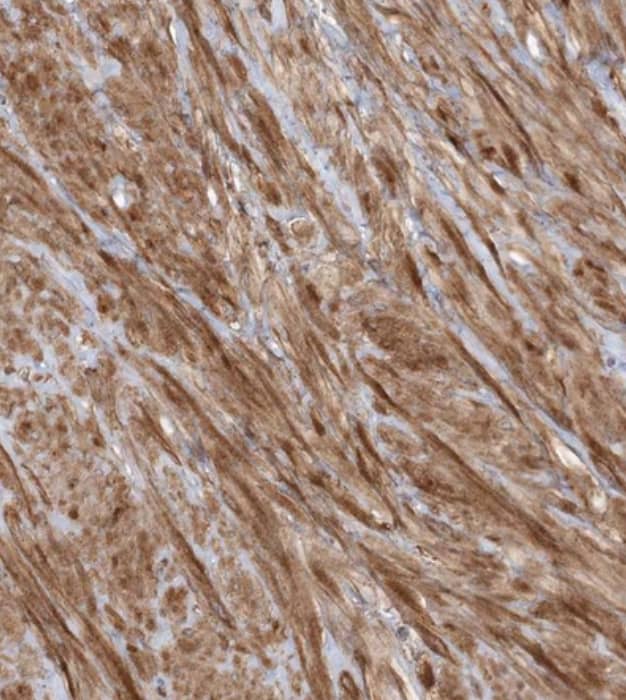 Staining of human prostate shows strong cytoplasmic positivity in smooth muscle cells.