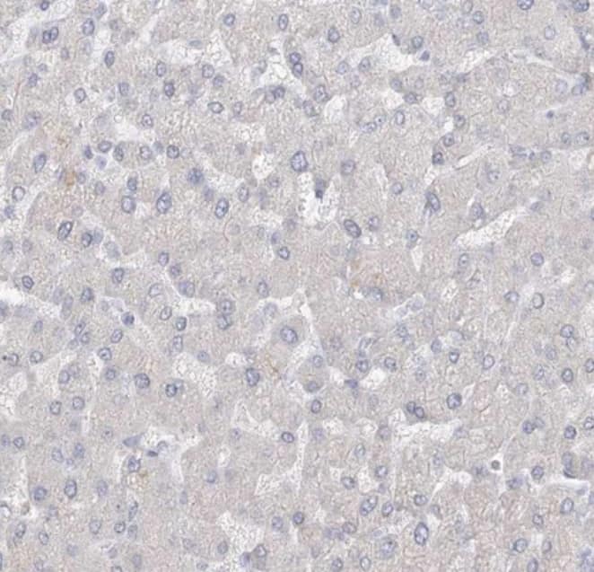 Staining of human liver shows no positivity in hepatocytes as expected.
