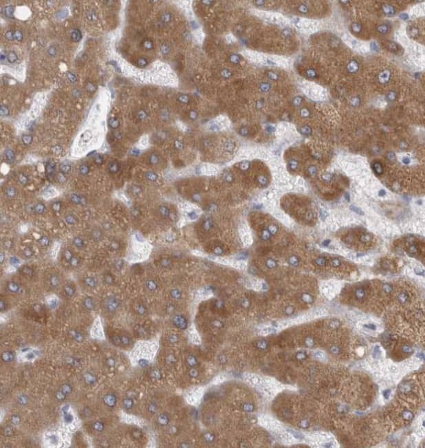 Staining of human liver shows moderate cytoplasmic positivity in hepatocytes.