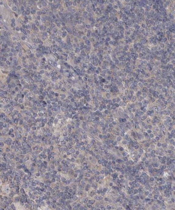 Staining of human tonsil tissue shows no positivity in non-germinal center cells.